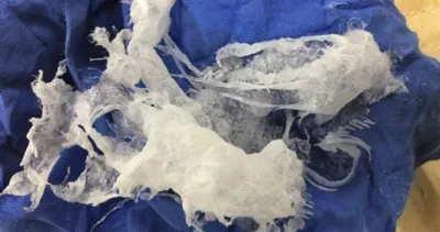 Silicone like white polymer mass removed from an A/C service unit